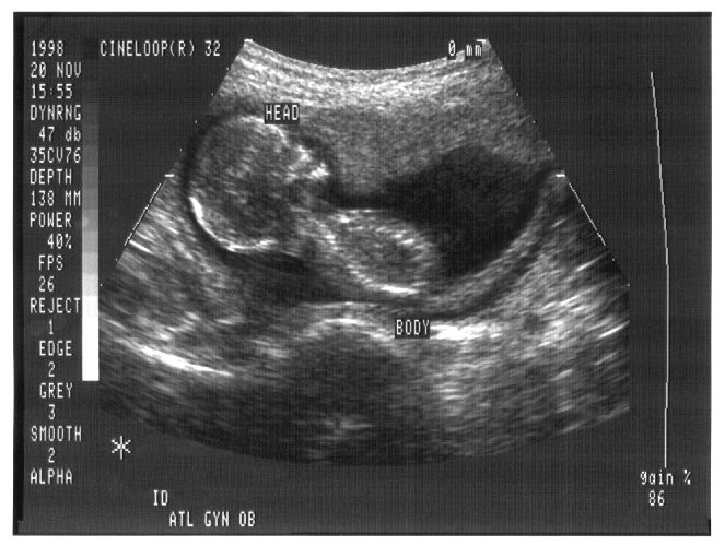 Baby development 4 months 