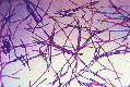 A photomicrograph of Bacillus anthracis bacteria using Gram stain technique.