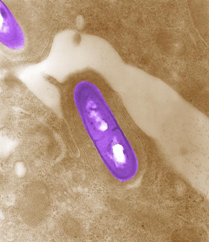 Listeria bacterium in tissue