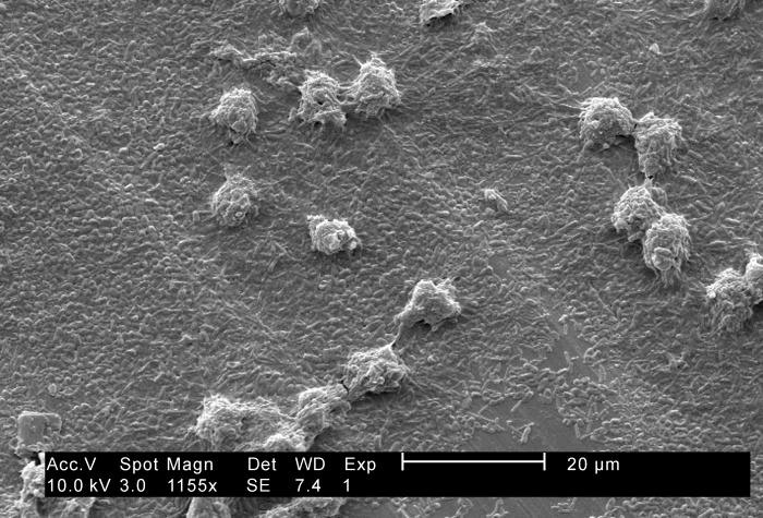 Hartmannella vermiformis amoebae trophozoites