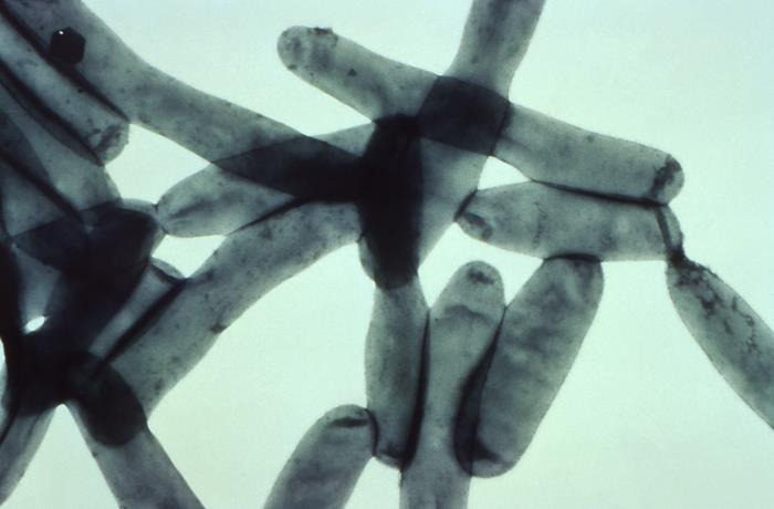 Legionella pneumophila bacteria