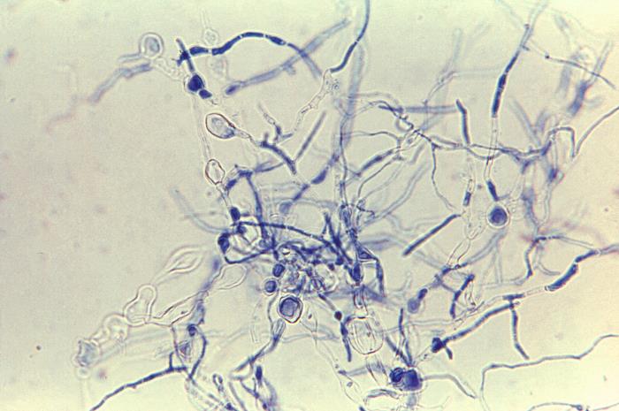 Clostridium Botulinum Morphology