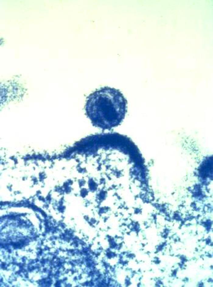 HIV particle budding from a cell. 