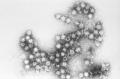 Scanning electron photomicrograph of polio virions.