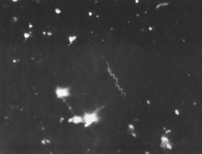 A dark field photomicrograph of a Treponema pallidum bacterium.