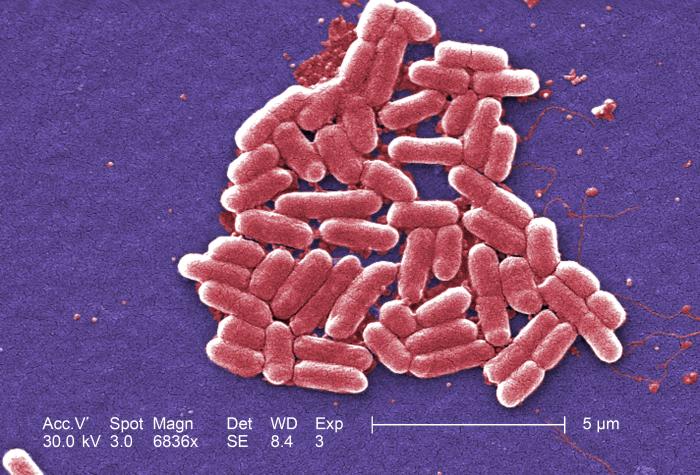 e coli gram stain 100x