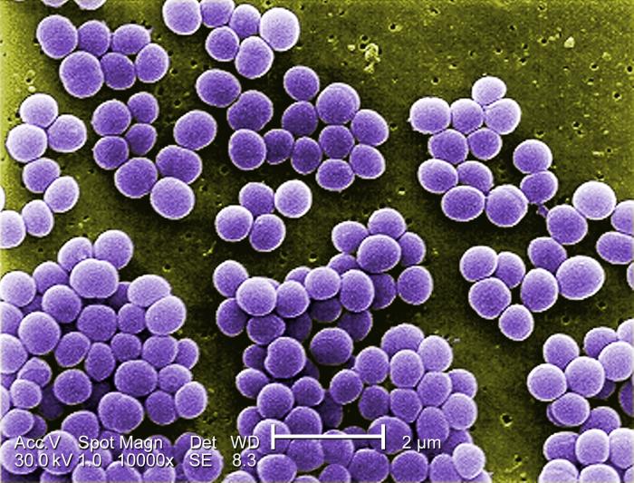 Staphylococcus aureus photo.