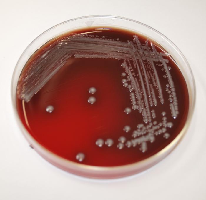 CDC Lab Dish Image