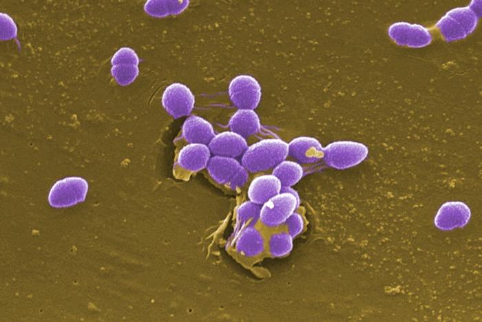 streptococcus faecalis gram stain