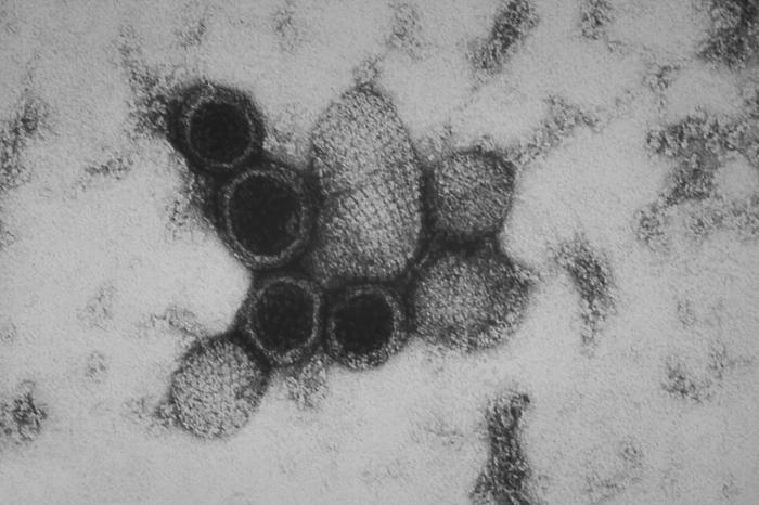transmission electron microscopic image of Hantavirus