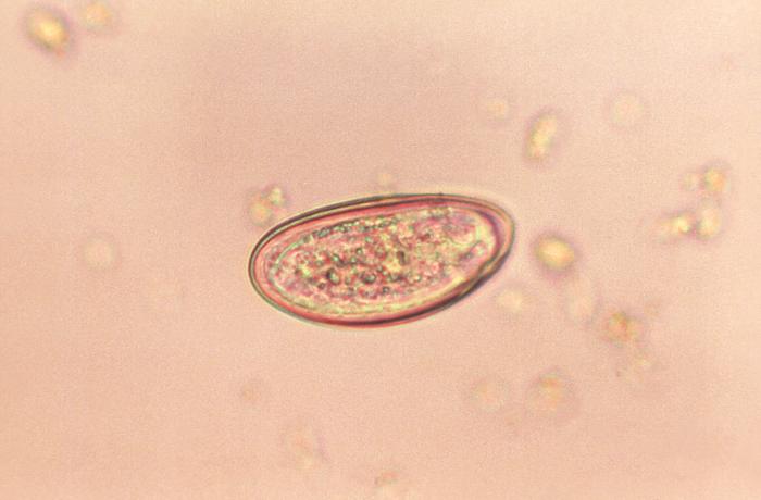 pinworm eggs visible