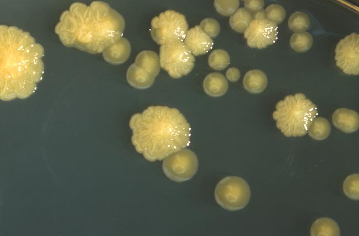 PDF) Fatal Cronobacter sakazakii sequence type 494 meningitis in a