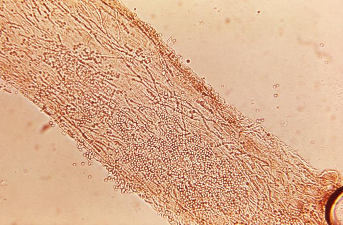 Phil Image 18305