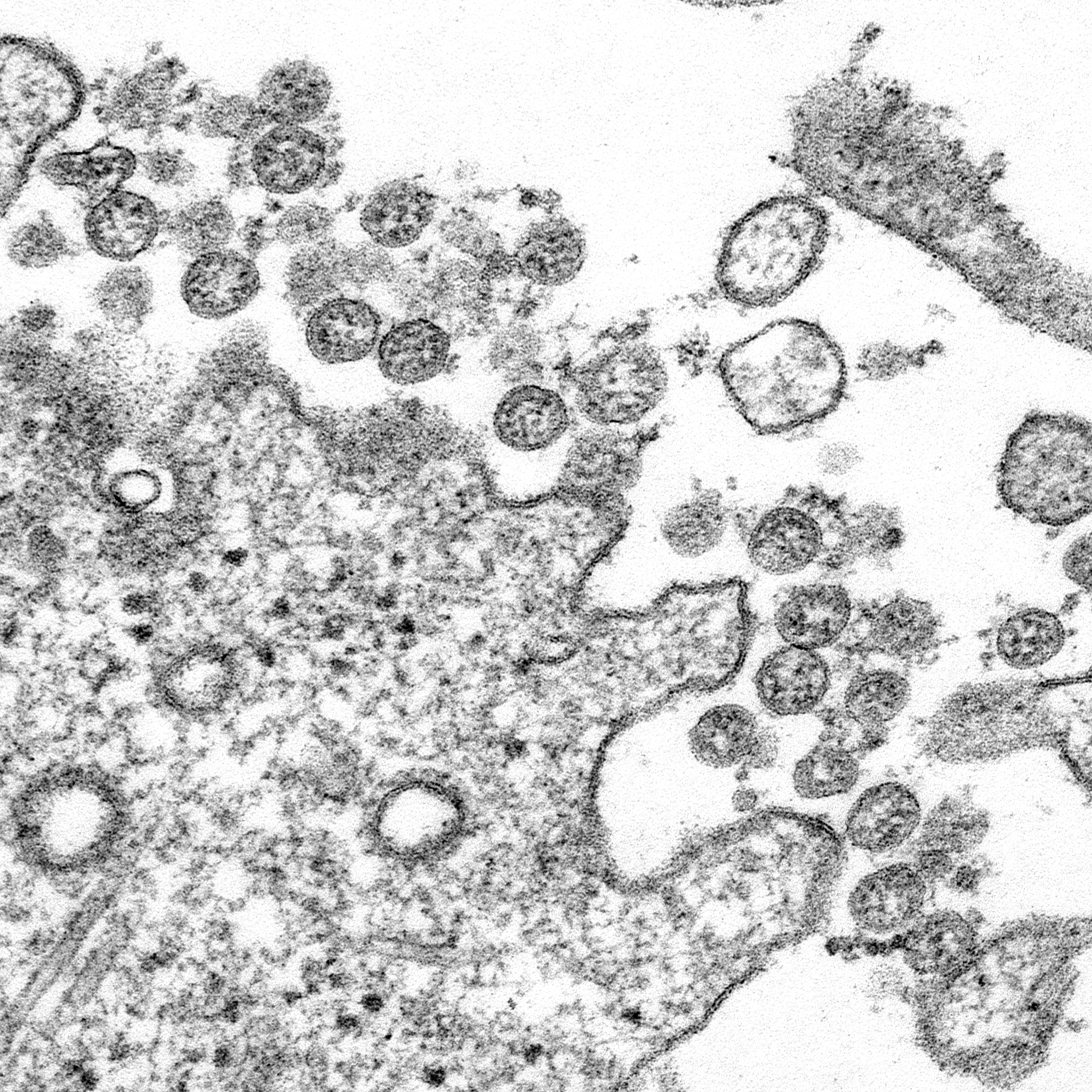 Coronavirus Image Png Download