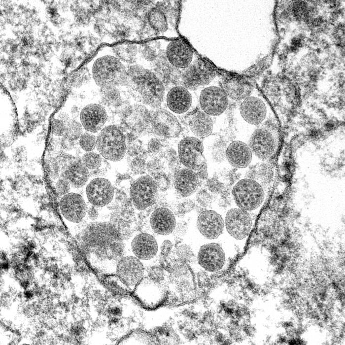 Zdjęcie Sars-cov-2 w mikroskopii elektronowej