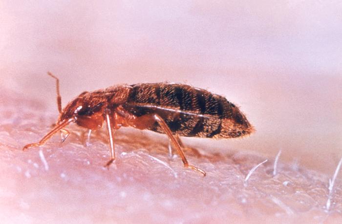Bed bug on skin