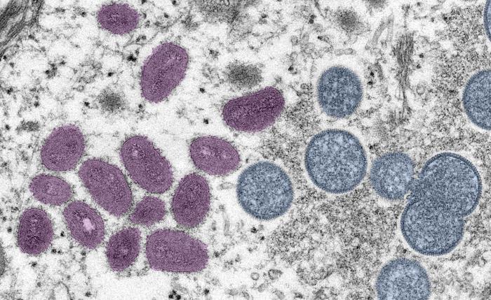 Digitally-colorized electron microscopic (EM) image depicted monkeypox virus particles, obtained from a clinical sample associated with the 2003 prairie dog outbreak.