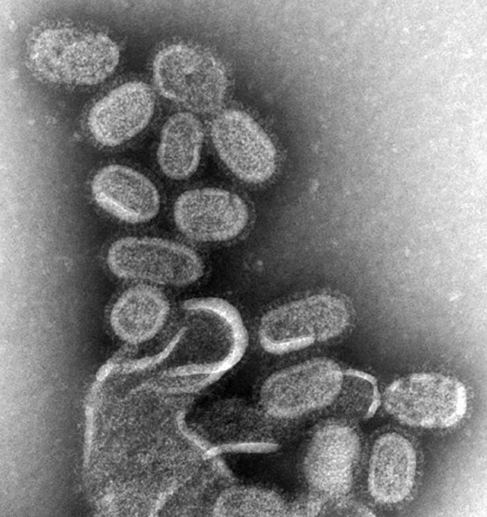 This negative stained transmission electron micrograph (TEM) shows recreated 1918 influenza virions that were collected from supernatants of 1918-infected Madin-Darby Canine Kidney (MDCK) cells cultures 18 hours after infection