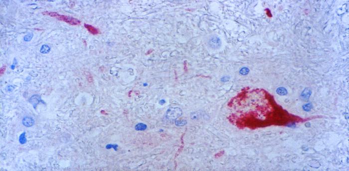 Photomicrograph of Haemophilus influenzae using immunofluorescence.