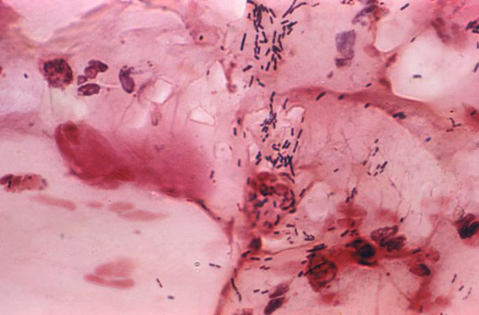 Gram-stained photomicrograph