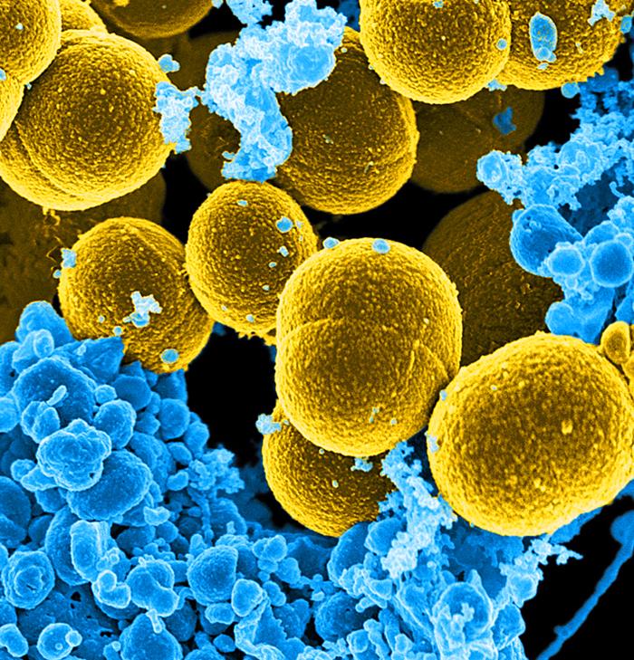 spheroid-shaped Staphylococcus aureus bacteria that were in the process of escaping their destruction by blue-colored human white blood cells