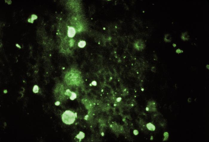 This immunofluorescent micrograph reveals a positive result for the presence of rabies virus antigens in this specimen.