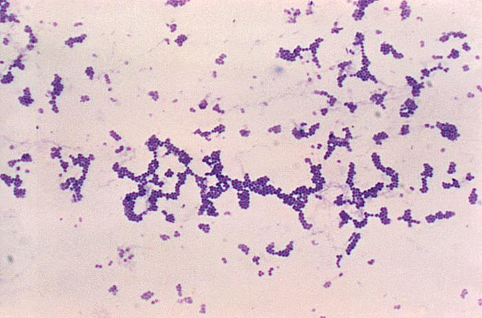 Streptococcus pyogenes в гинекологии