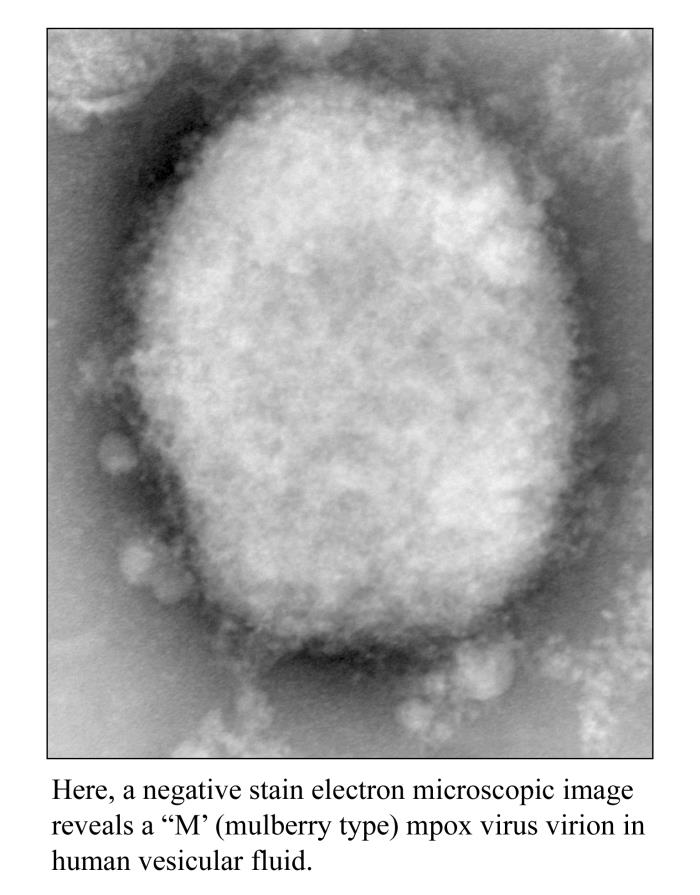 Unveiling the Secrets of the Nucleus – Why It Stains a Specific Color