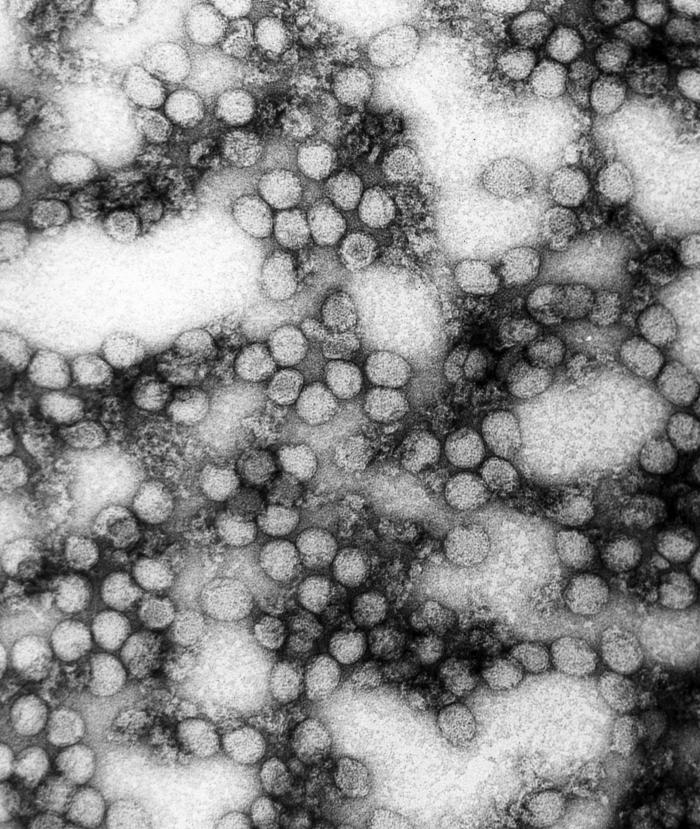 This photomicrograph shows multiple virions of the yellow fever virus at a magnification of 234,000x.