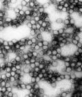 This photomicrograph shows multiple virions of the yellow fever virus at a magnification of 234,000x.