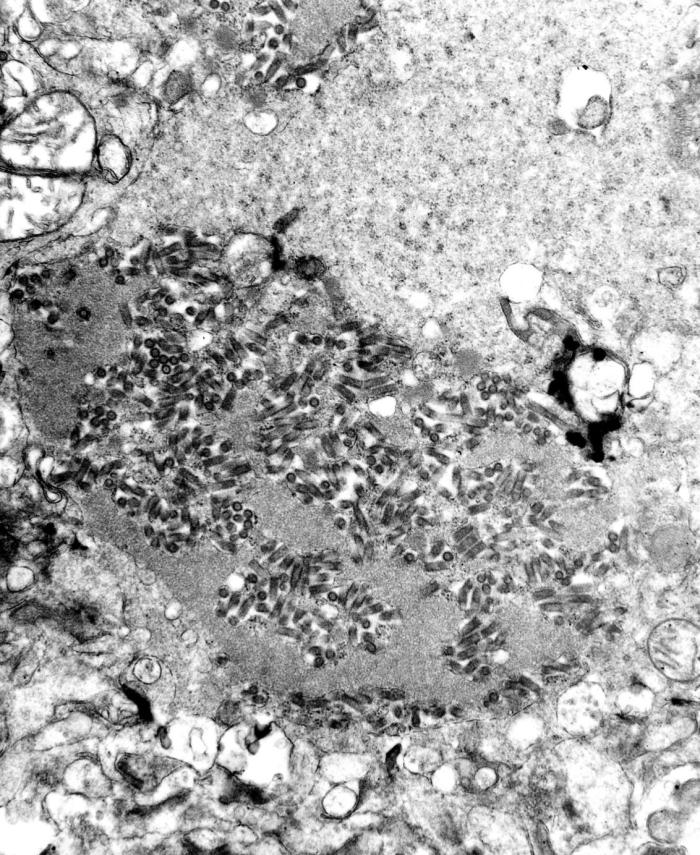 This transmission electron micrograph (TEM) revealed the presence of numerous dark, bullet-shaped rabies virions within an infected tissue sample.
