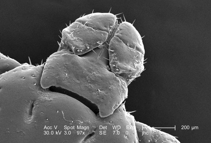 A tick under a microscope