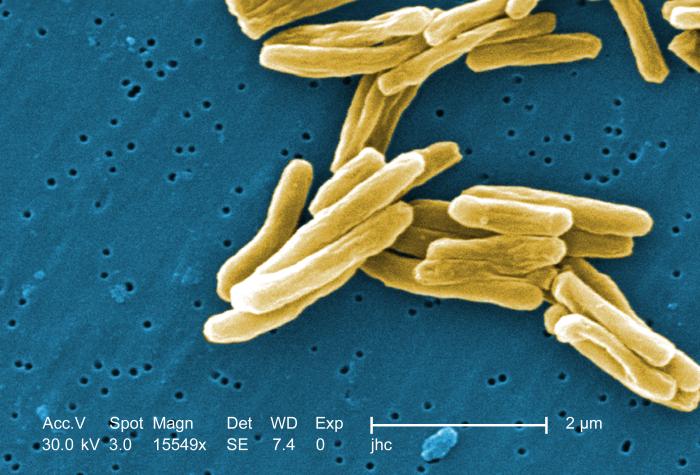 Gambar Mikroskopis Mycobacterium tuberculosis