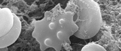 electron micrograph image
