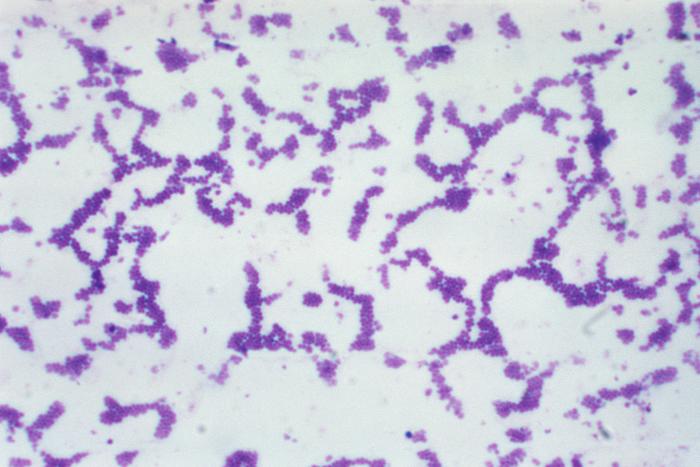 Organisms That Can Cause Pneumonia (Bacteria)