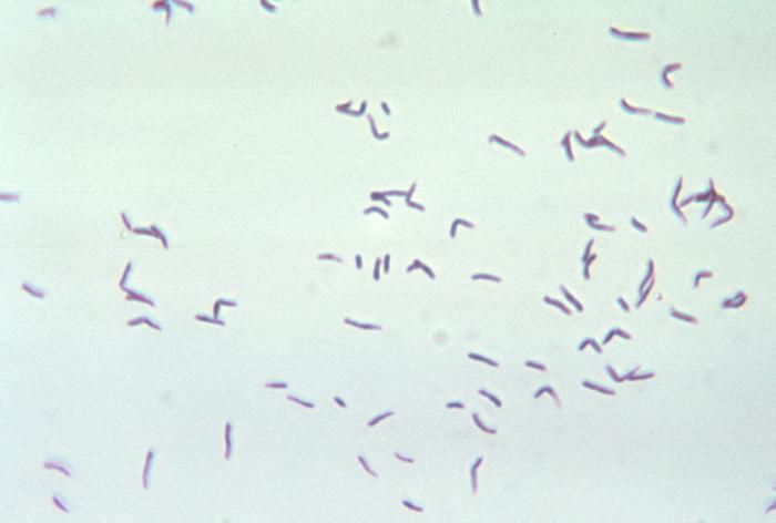 Gram Positive Asporogenous Rods Regular